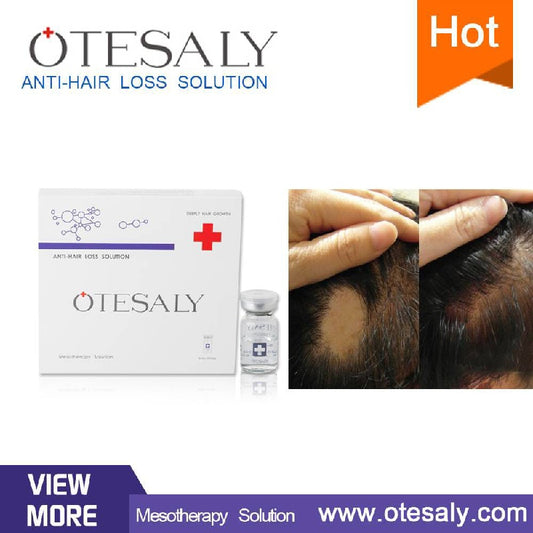 Otesaly Anti Hair Loss Solution